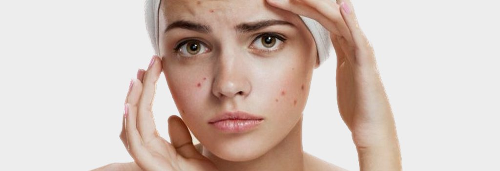 acne extraction Bangkok